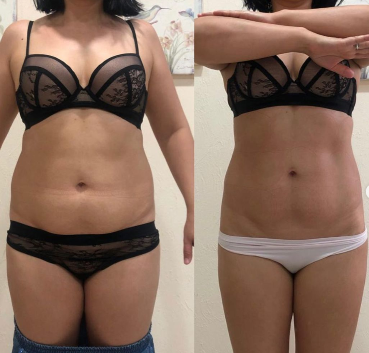 Body Shaping Machine Ems Message Fat Rotation Elimination